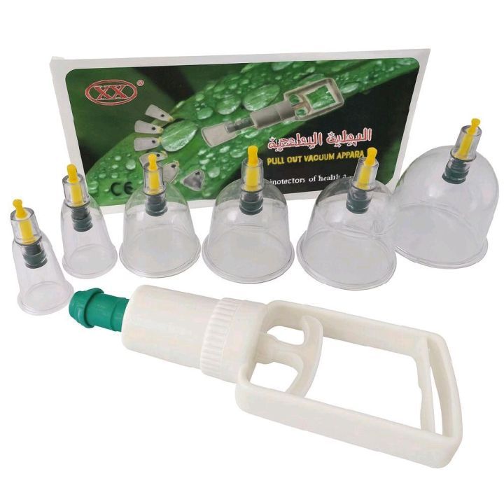 Alat Bekam Kop Angin 6 PCS ALAT BEKAM KOP ANGIN 6 PCS PULL OUT A VACUUM