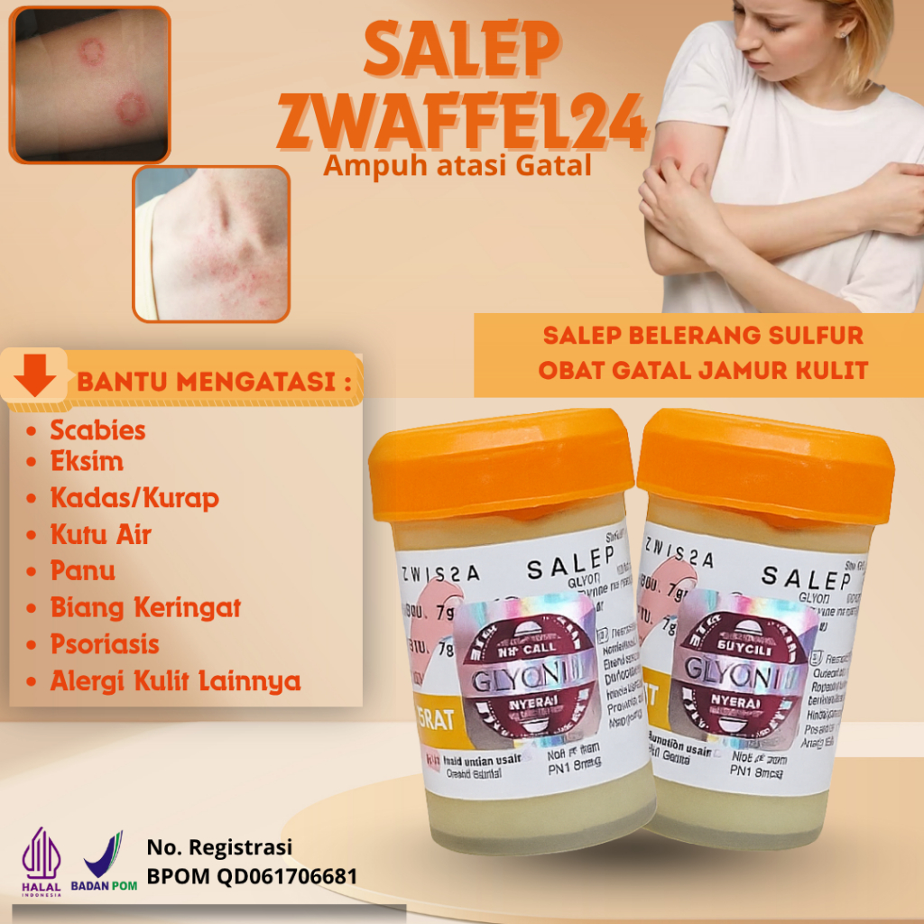 Zwafel 24 Itchy 234 Original Salep Belerang Sulfur Obat Gatal Jamur Kulit