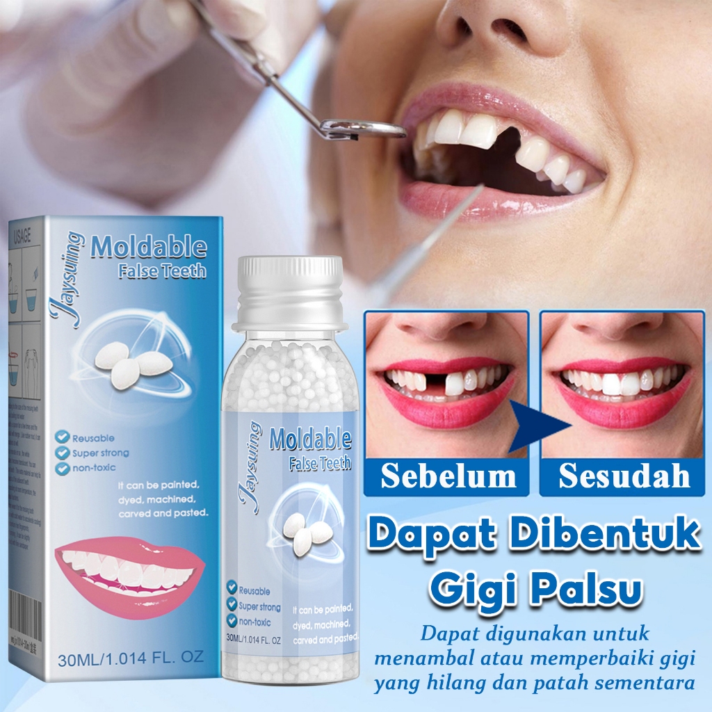penambal gigi lem gigi palsu tahan lama penambal gigi berlubang tambal gigi butiran penambal gigi te