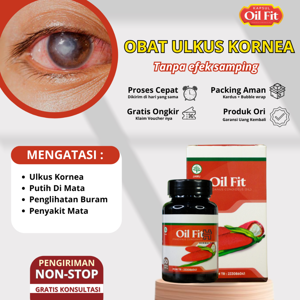 Obat Tukak Ulkus Kornea Penglihatan Buram, Ulkus Kornea, Obat Luka Pada Mata, Penghilang Mata Terasa