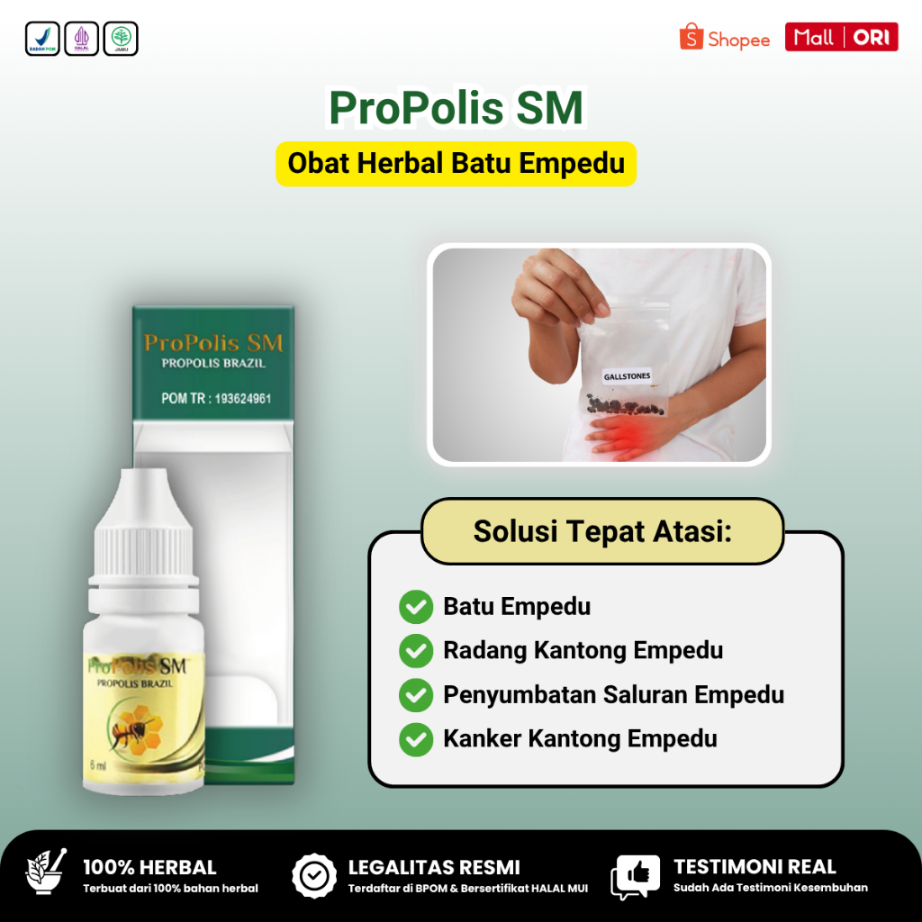 Propolis SM - Obat Batu Empedu, Obat Penghancur Batu Empedu, Obat Peluruh Batu Empedu