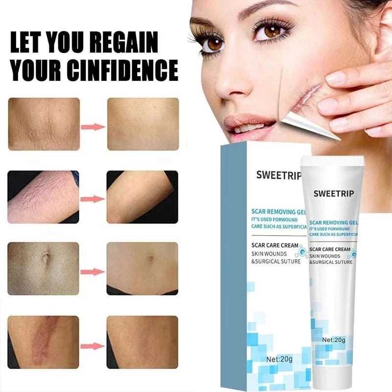 20g SWEETRIP Salep Menghilangkan Bekas Luka, Hilangkan Bekas Koreng, Hilangkan Bekas Luka Bakar, Hil