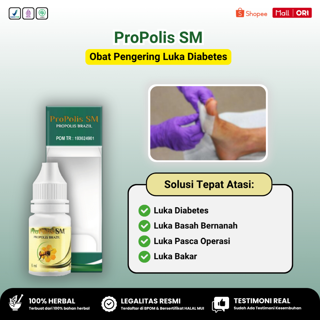 Obat Pengering Luka Diabetes Luka Basah Bernanah Diabetes Penyakit Gula Kencing Manis Propolis SM