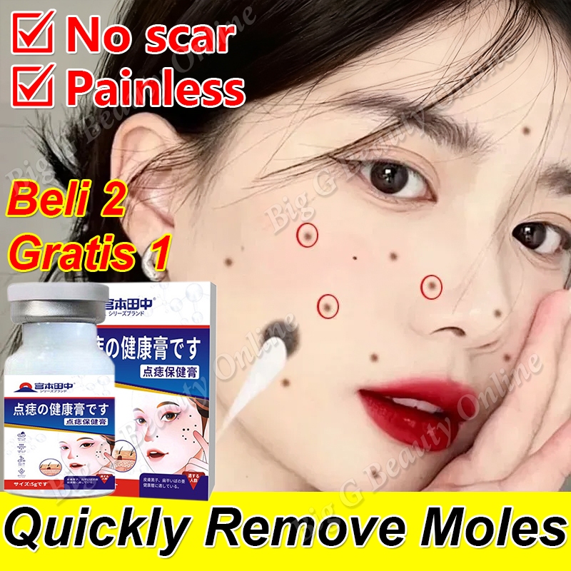 Obat Penghilang Tahi Lalat Di Wajah Penghilang Tahi Lalat Mati Penghilang Taik Lalat Di Wajah Skin T