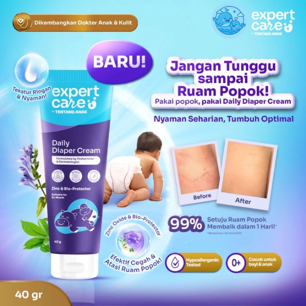 Diaper Rash Cream - Expert Care Daily Diaper Cream 40g dengan Zinc Oxide, Panthenol & Bio-Protector