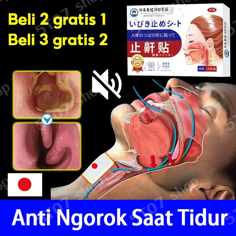 Anti Ngorok Saat Tidur 12pcs alat anti ngorok saat tidur alat anti ngorok alat ngorok saat tidur pen