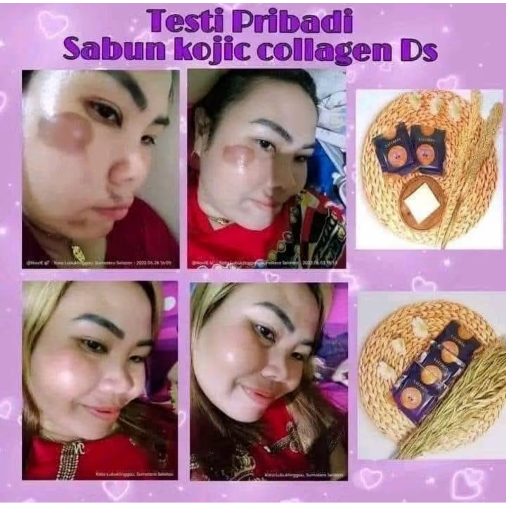 WHITENING KOJIC SAFFRON 30gr | SABUN KOJIC BPOM ORI RATU DS