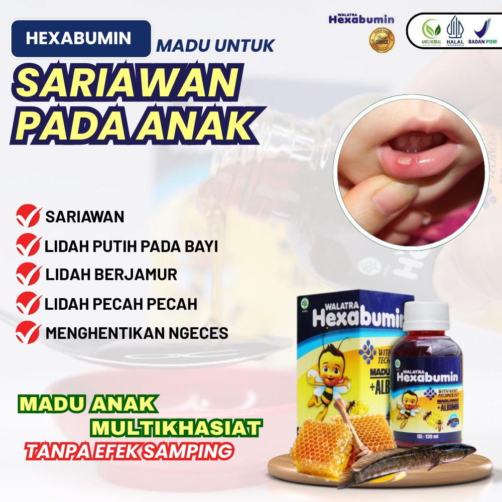 Obat Sariawan Pada Anak, Sariawan Di Lidah, Sariawan Di Bibir, Lidah Putih Pada Bayi, Lidah Jamuran,