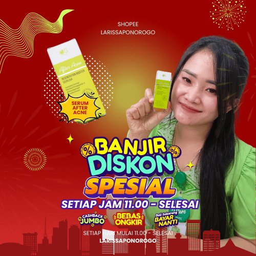 SERUM UNTUK BOPENG TIPIS LARISSA SERUM AFTER ACNE LARISSA PONOROGO