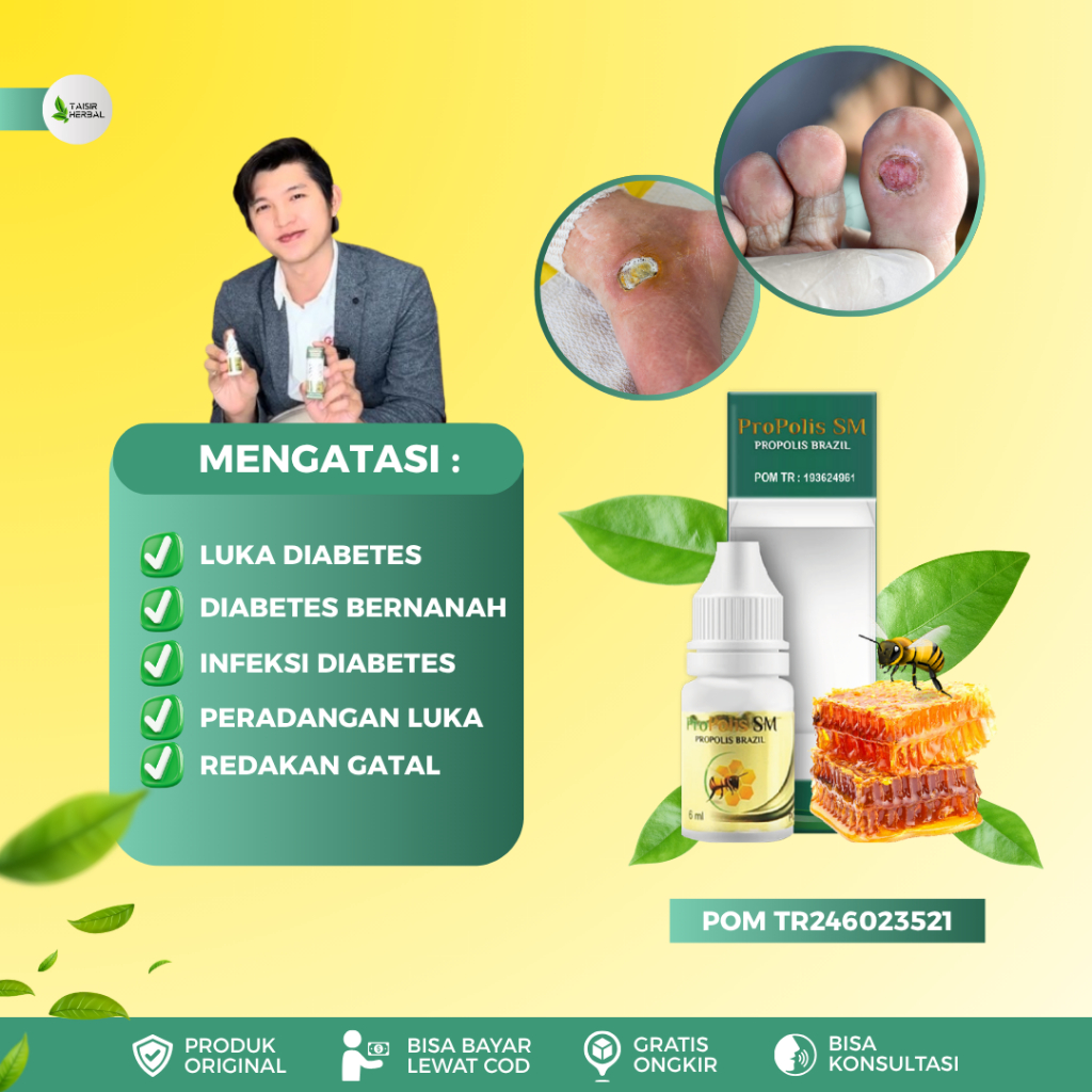 Obat Pengering Luka Diabetes - Peradangan Luka Infeksi Luka Diabetes - Infeksi Kulit Diabetes Bernan