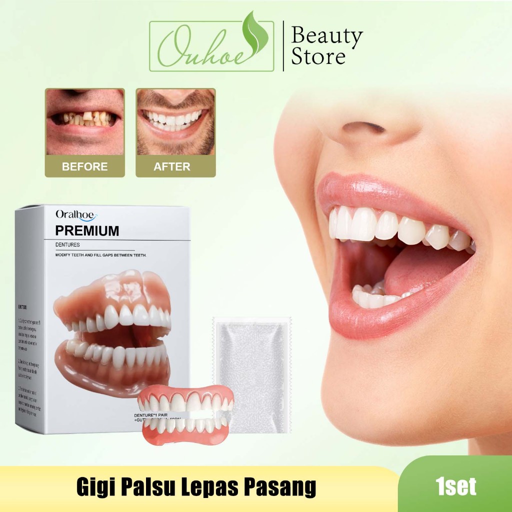 Oralhoe Gigi Palsu Lepas Pasang 1set - Pasang Gigi /Sempurna Merapikan Gigi Dengan Veneer