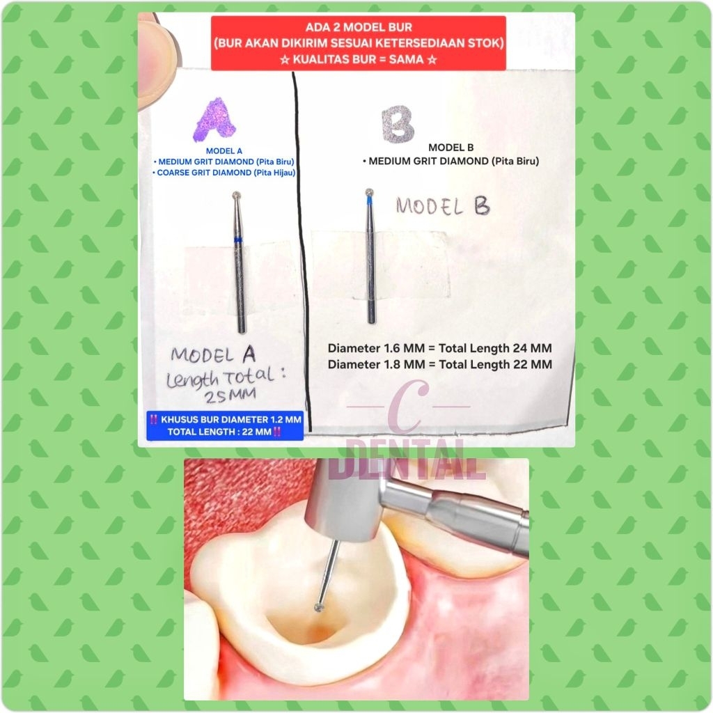 [1 Piece] Dental Endo Access Opening Orifice Bur Diamond Long Shank Round Shape High Speed