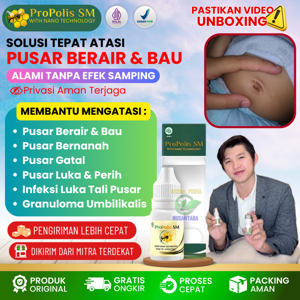Obat Tetes Oles Pusar Berair, Pusar Berair Dan Bau, Pusar Gatal, Pusar Bengkak, Infeksi Tali Pusar B