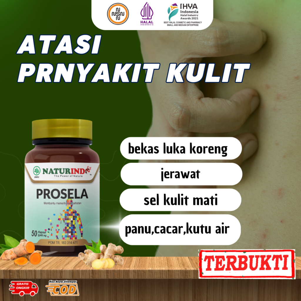 PROSELA - NATURINDO Obat Menghilangkan Bekas Luka Jerawat Koreng Borok Menghitam Paling Ampuh
