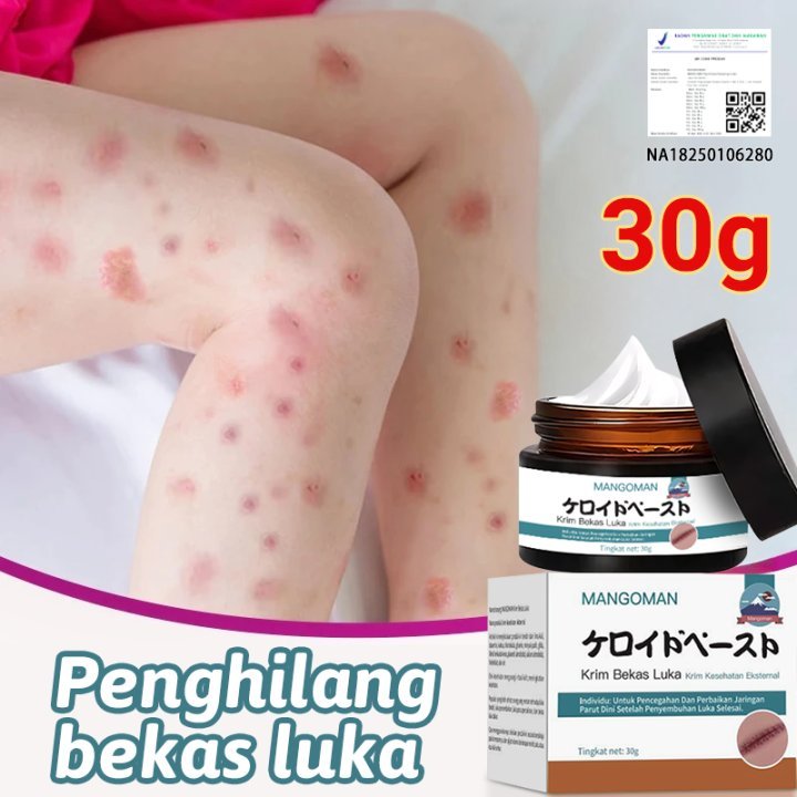 COD Mangoman Penghilang Bekas Luka Koreng Cepat Kering Advanced Scar Gel Mangoman Obat Bekas Luka Lu