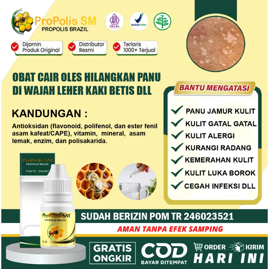 Obat Caiir Penghilang Panu Untuk Anak Dewasa, Salep Hilangkan Panu,  Di Tubuh, Lengan, Leher, Punggu
