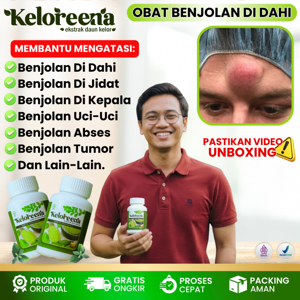 Obat Benjolan Di Dahi, Benjolan Di Jidat, Obat Benjolan Di Wajah,  Obat Benjolan Di Kepala, Obat Ben