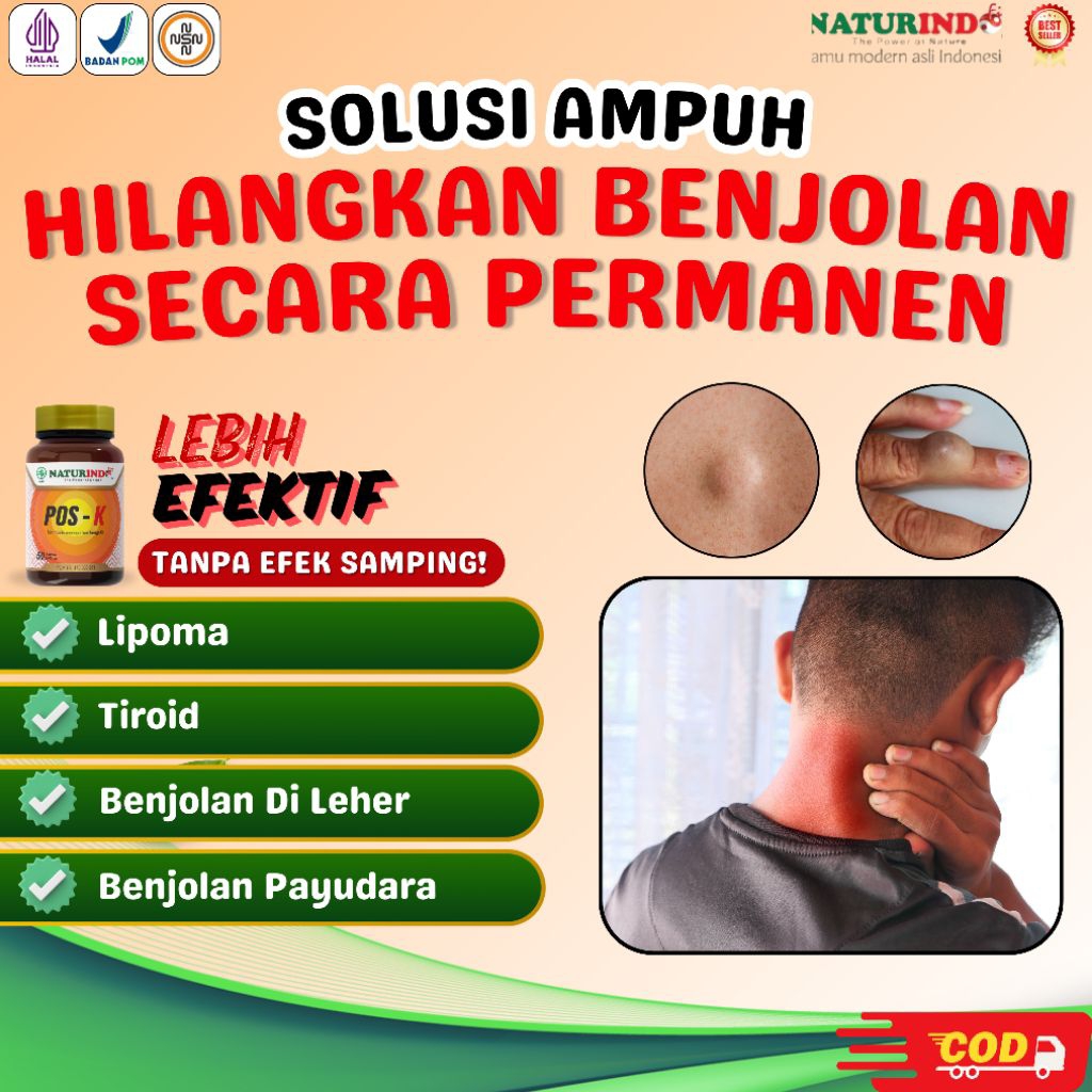 Obat Benjolan Lipoma Tiroid Leher Herbal Ampuh Pos-K Naturindo