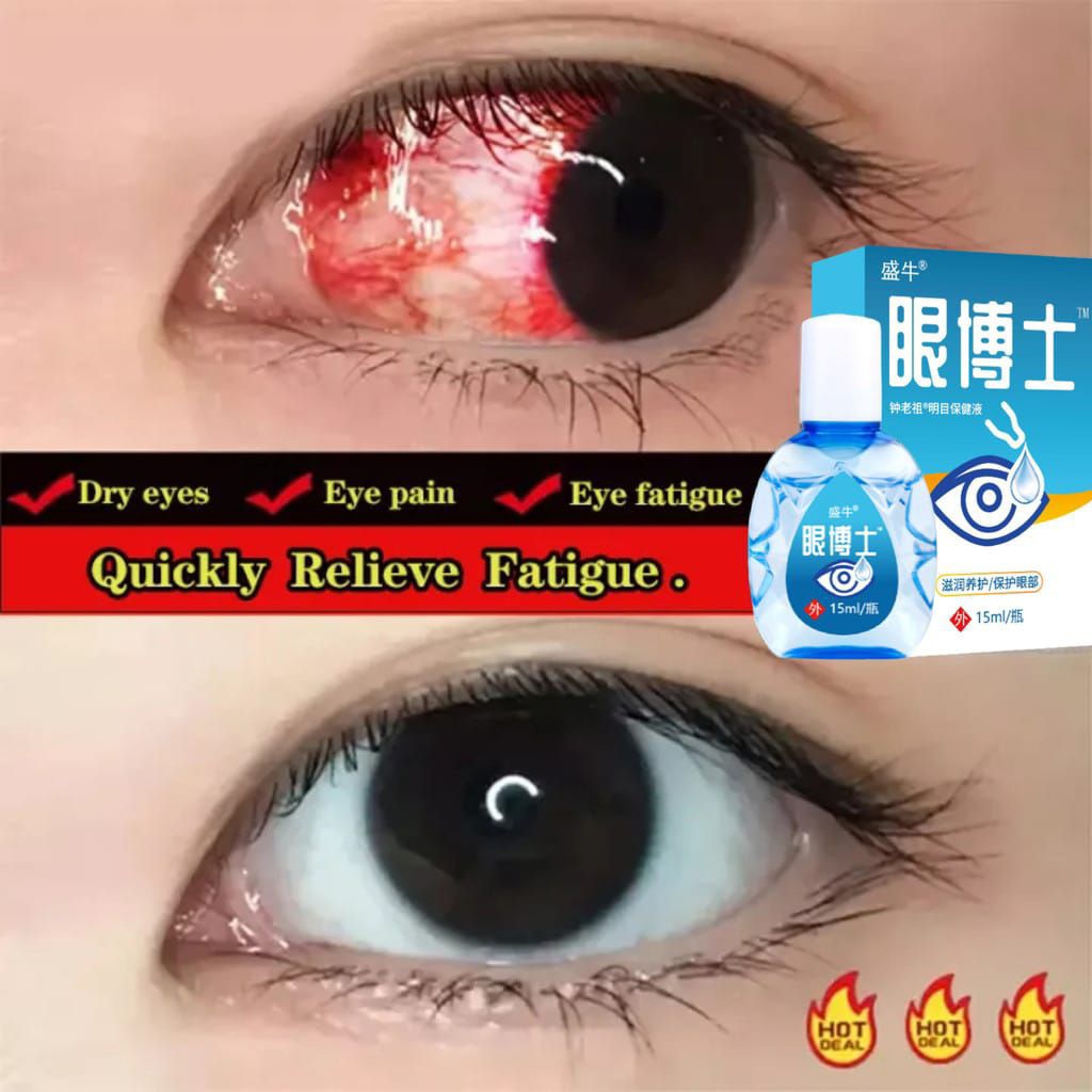 Obat Tetes Mata Anak Dan Dewasa Atasi Mata Katarak Mata Kering Sakit Mata Darah Merah Ketegangan Mat