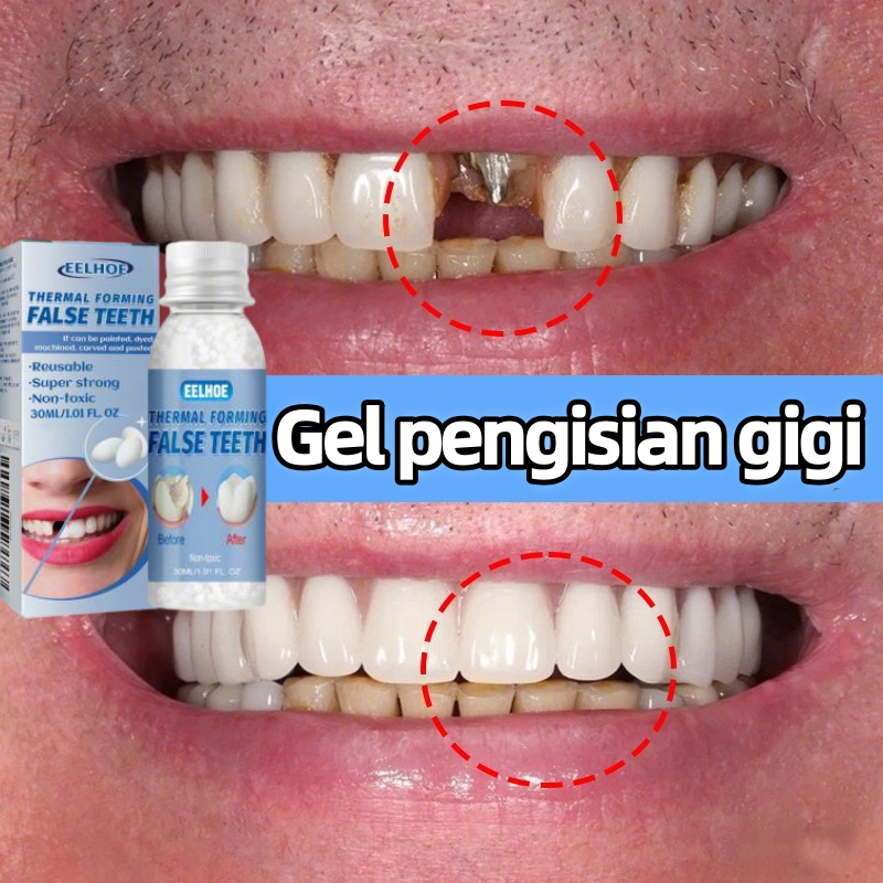Penyelamat Gigi / Gel Gigi Padat / Menambal Gigi Palsu / Menambal Gigi Berlubang / Memperbaiki Gigi 