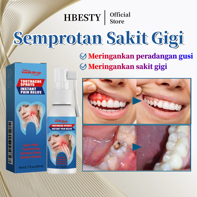 HBESTY Sakit gigi ampuh Toothache spray sakit gigi Semprotan sakit gigi Sakit gigi berlubang Semprot