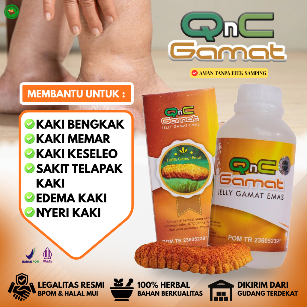 Jelly Gamat Emas, Obat Kaki Bengkak, Kaki Bengkak dan Nyeri, Kaki Bengkak Ibu Hamil, Kaki Bengkak Ka