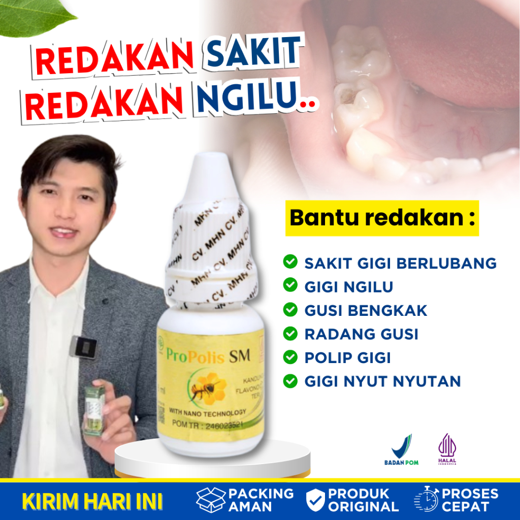 Obat Sakit Gigi Berlubang dan Ngilu Gigi Bolong Bau Busuk Nyut Nyutan Saraf Gigi Sariawan Bibir Muco