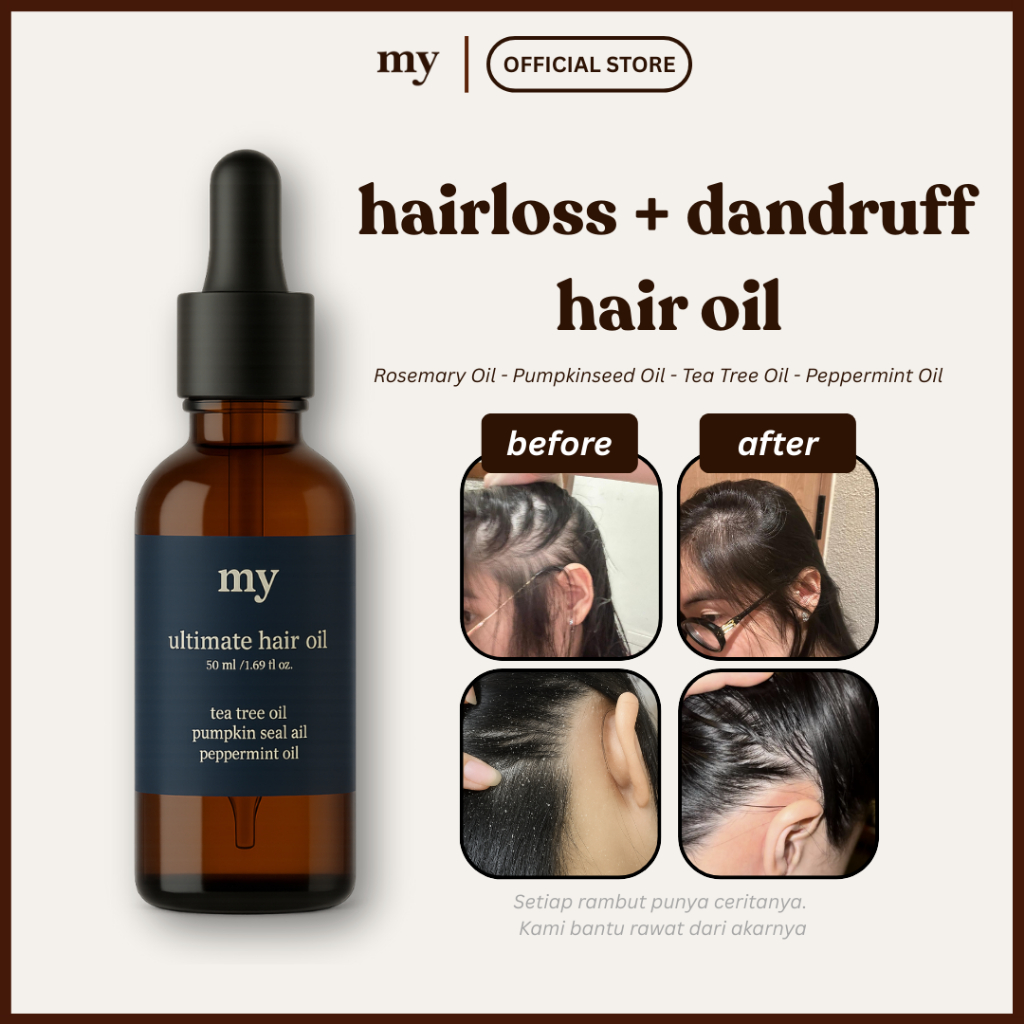 my Ultimate Hair Oil (Hairloss + Dandruff) - Rosemary Hair Oil Hair Ampoule Minyak Penumbuh Rambut H