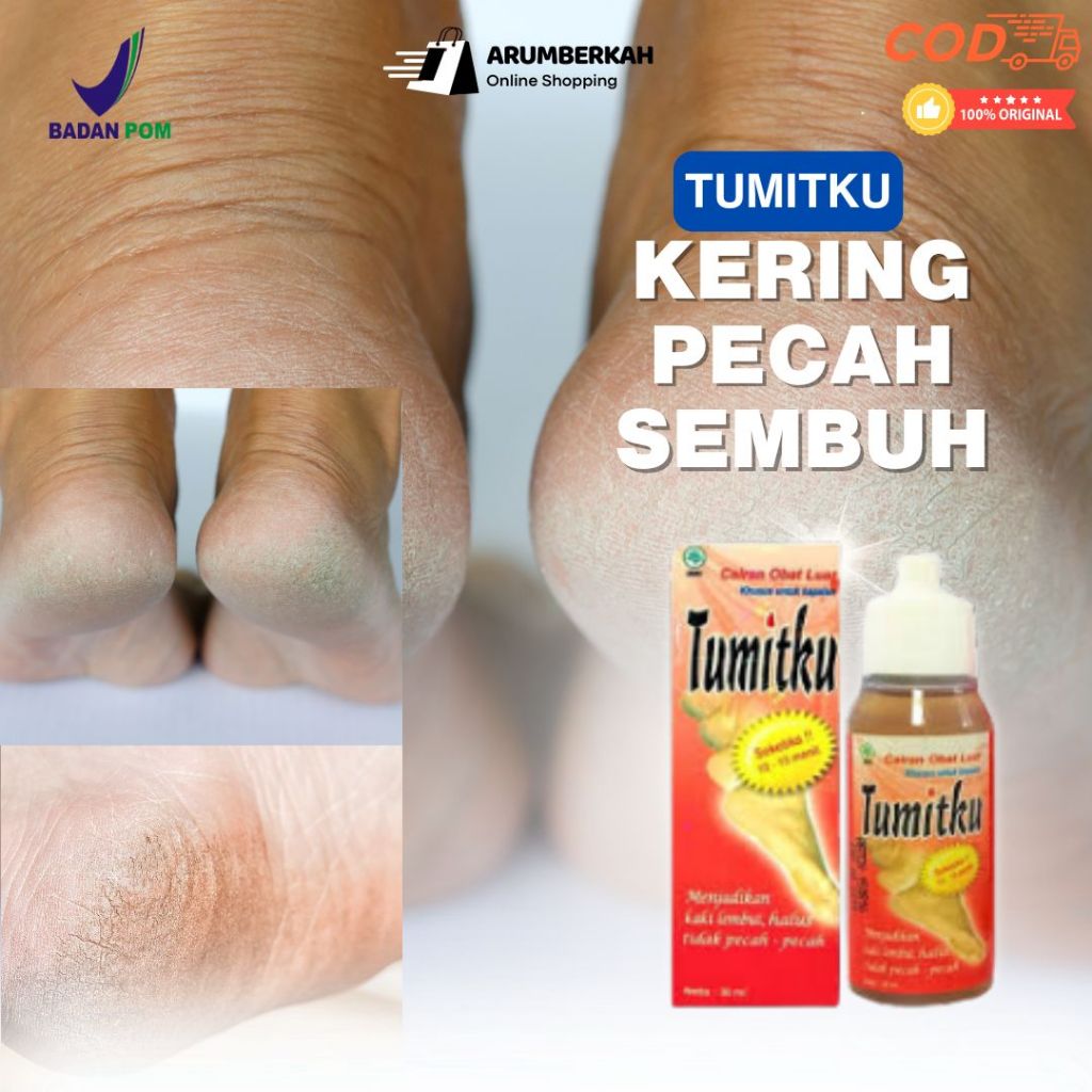 Tumitku  Obat Kaki Pecah Dan Kering Ampuh Obat Tumit Pecah Dan Kering Pembersih Kaki Pecah Obat Kaki