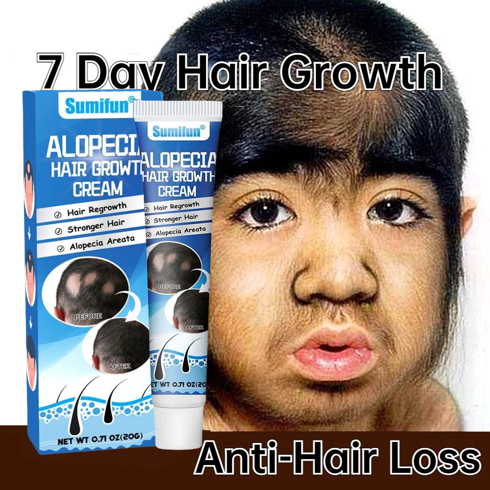 Penumbuh rambut Obat rambut Penumbuh rambut botak 20g obat penumbuh rambut penumbuh rambut cepat oba