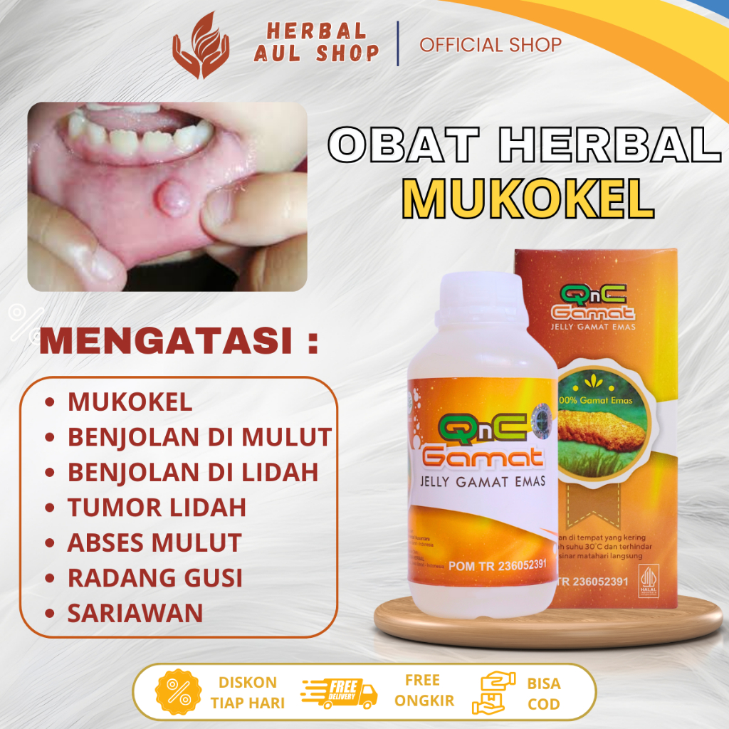 Obat Mukokel, Benjolan Di Mulut, Benjolan Di Lidah, Tumor Lidah, Abses Mulut,  Radang Gusi Dan Saria