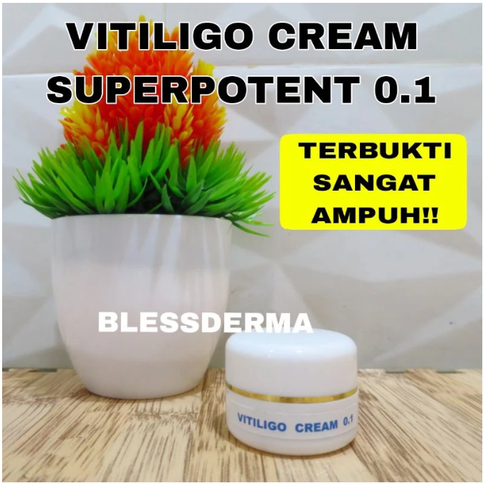 Blessderma Cream Vitiligo 0.1 dengan kandungan Protopic sangat ampuh mengatasi vitiligo Kulit belang