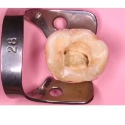 NeoDam | Oral Dam | Rubber Dam Sheet 1 piece | Natural Rubber Latex Dental Dam