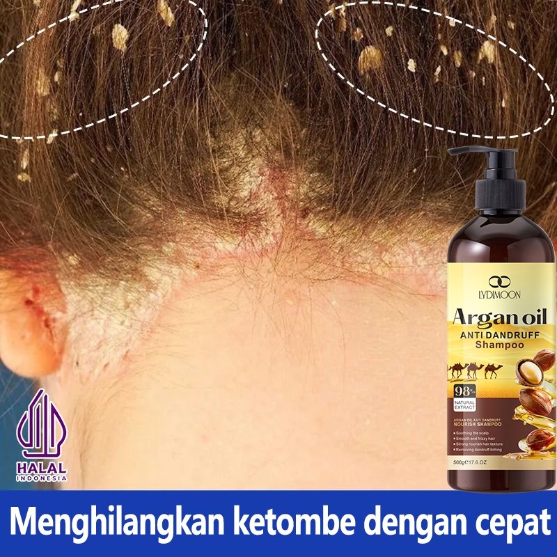 Shampo anti ketombe/Shampoo rambut/Shampo Minyak Kacang 500g Oil control Penghilang ketombe berkerak