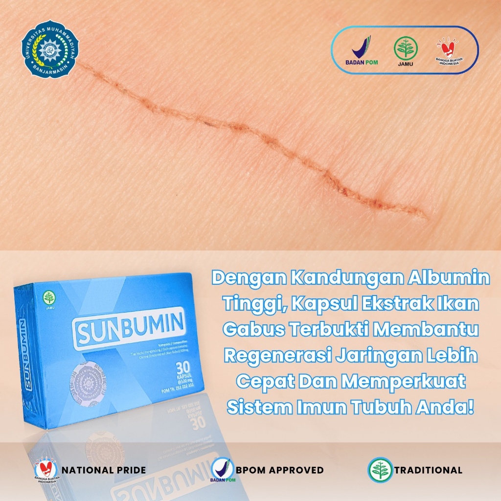 SUNBUMIN SUPLEMEN IKAN GABUS PERCEPAT PEMULIHAN | SUPLEMEN IKAN GABUS | SUPLEMEN ALBUMIN IKAN GABUS