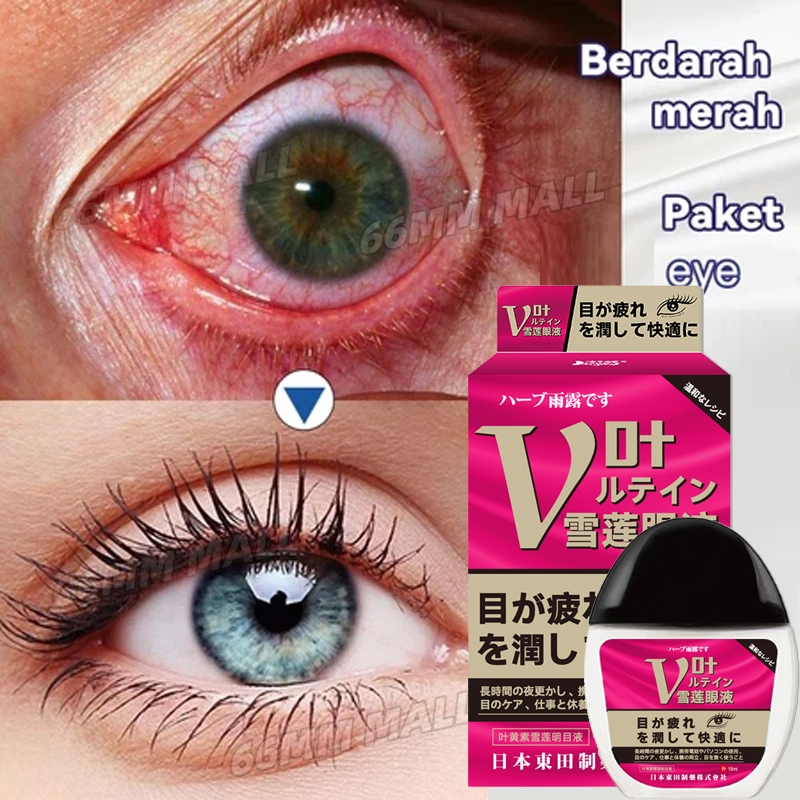 BEST SELLER OBAT TETES MATA JEPANG OBAT MATA KATARAK TETES MATA MINUS PALING AMPUH TETES MATA