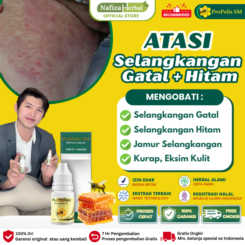 Propolis SM Obat Selangkangan Hitam dan Gatal, Pemutih Selangkangan Hitam, Obat Gatal Ruam Berjamur 