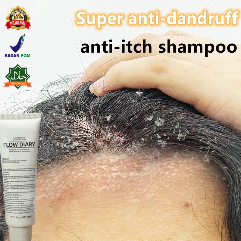 shampo anti ketombe shampoo anti ketombe dan rontok shampo selsun anti ketombe