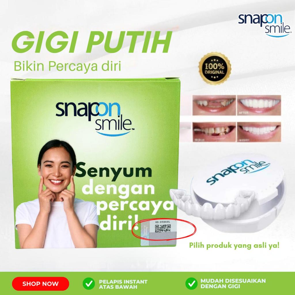 Snap On Smile original veneer gigi