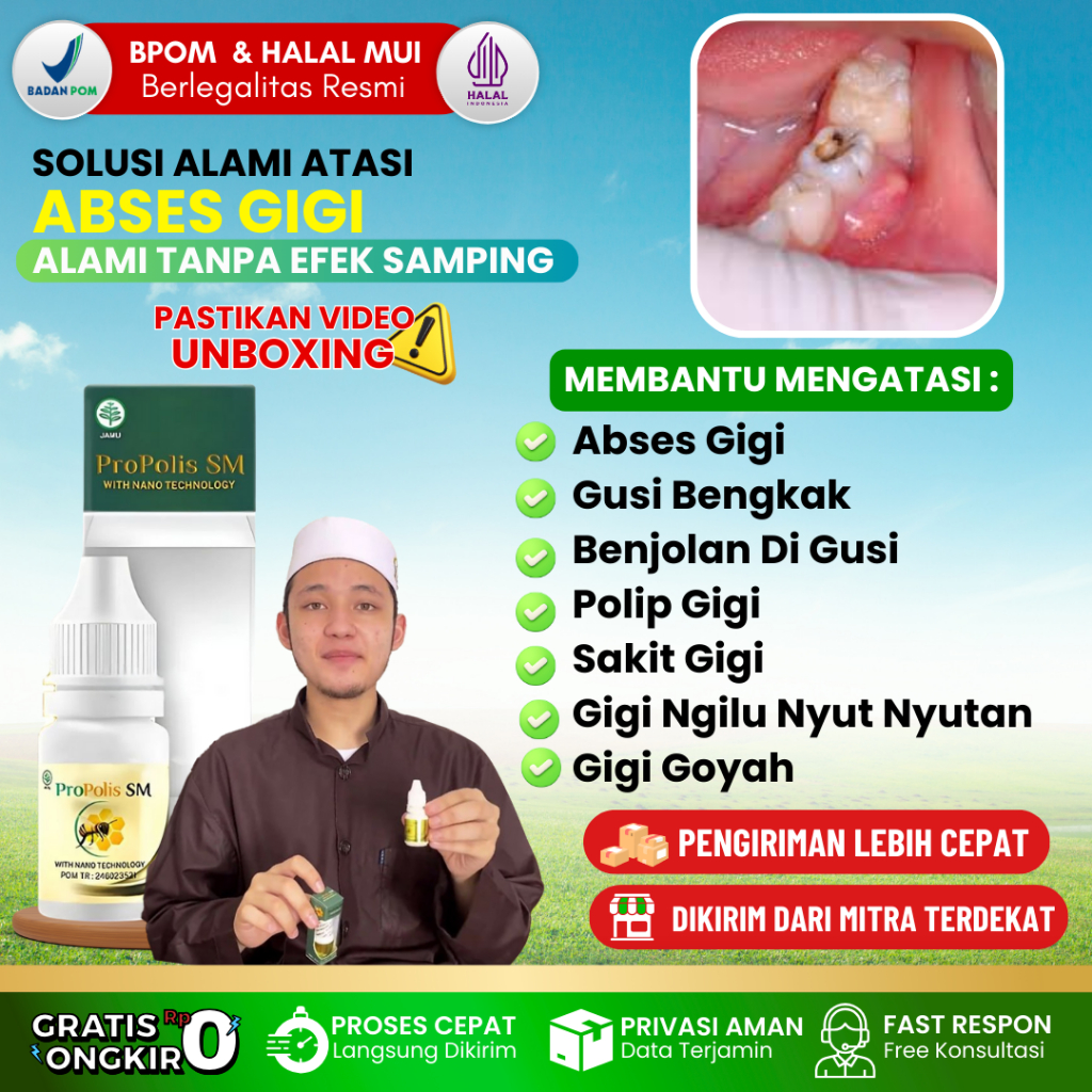 [COD] Obat Tetes Abses Gigi Bernanah - Obat Abses Gigi Untuk Anak - Obat Abses Gigi Bengkak - Obat A