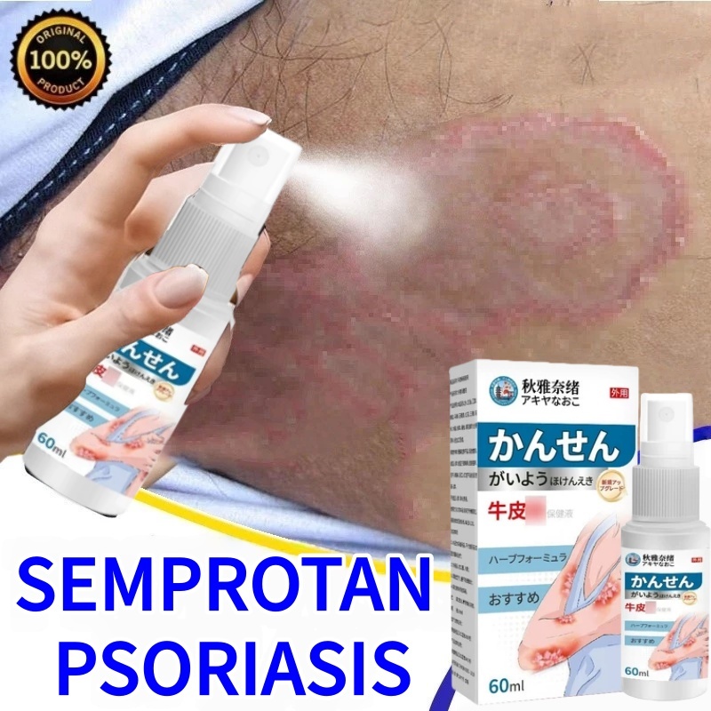 Obat gatal kulit Spray gatal paling ampuh Obat gatal gatal Obat gatal selangkangan Semprotan Anti Ga