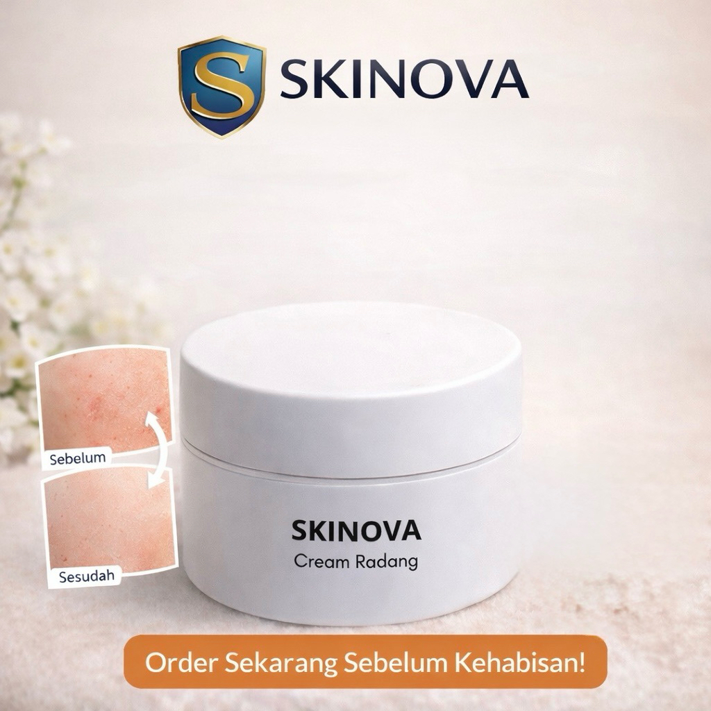 Skinova Cream Radang – Solusi Tepat Untuk Kulit Merah & Iritasi 10gr