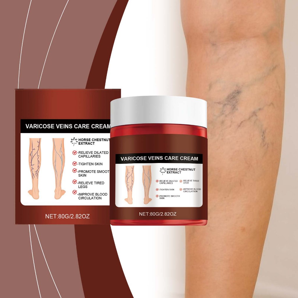 Varicose Veins Cream 80g Obat Varises Kaki Ampuh Obesitas Vaskulitis Flebitis Meringankan Kaki Sakit