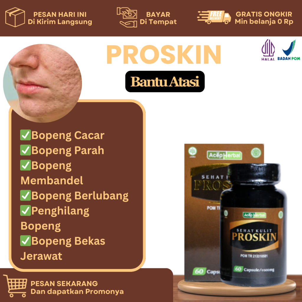 Obat Untuk Penghilang Bopeng, Bopeng Membandel, Bopeng Cacar, Bopeng Berlubang, Bopeng Parah, Bopeng