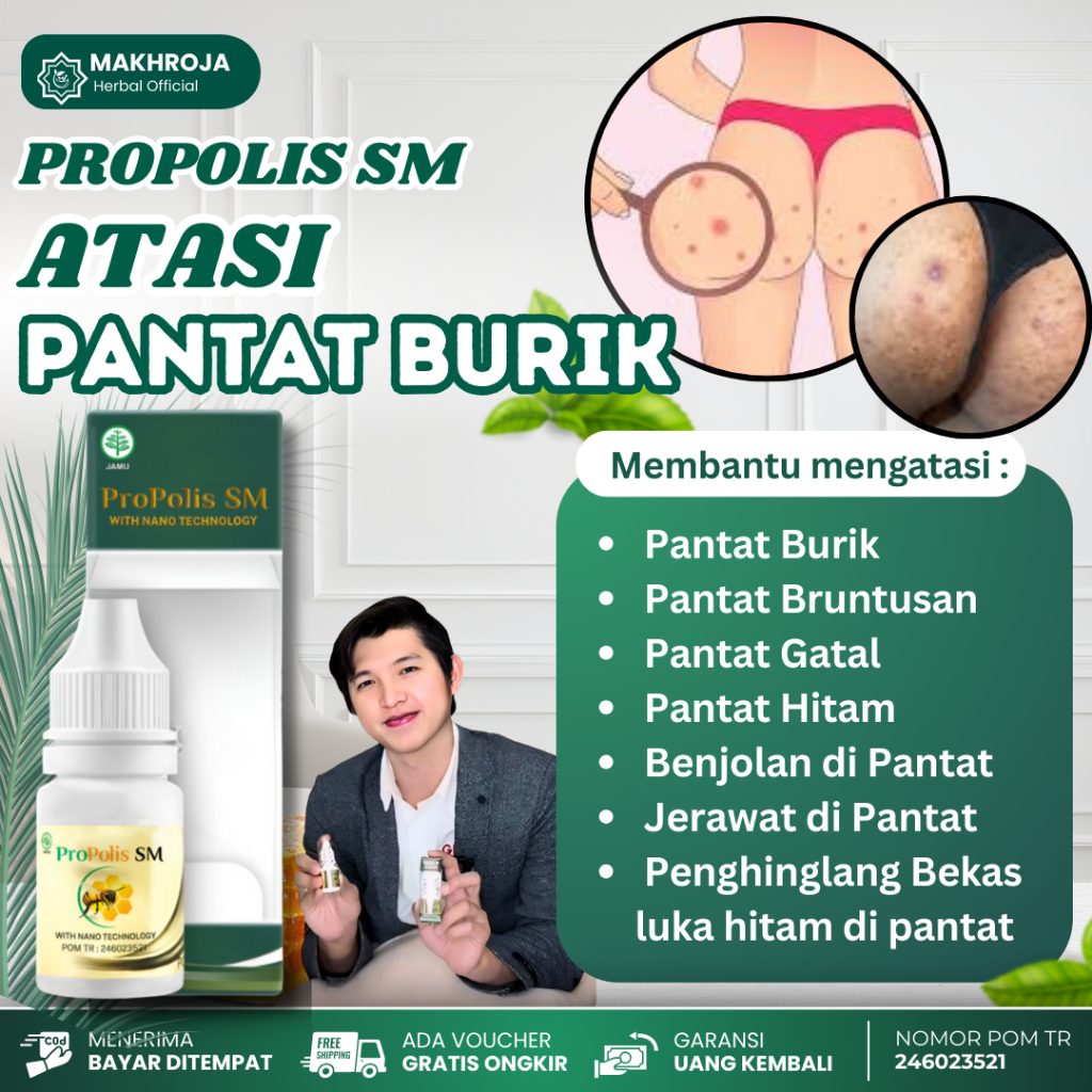 Obat Pantat Burik Hitam Beruntusan Gatal Penghilang Bekas Luka Benjolan - Propolis Sm
