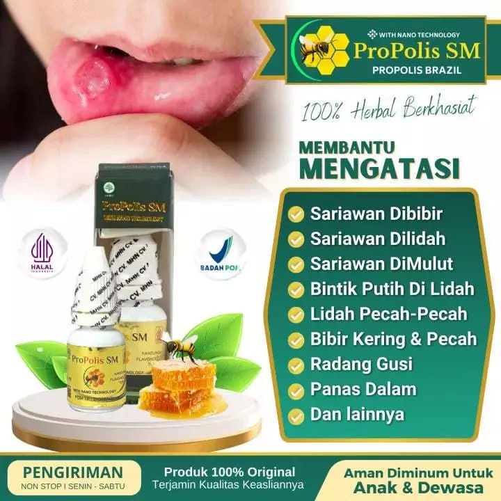 Obat Lidah Pecah-Pecah, Lidah Sariawan, Lidah Ngilu, Lidah perih - Propolis sm original