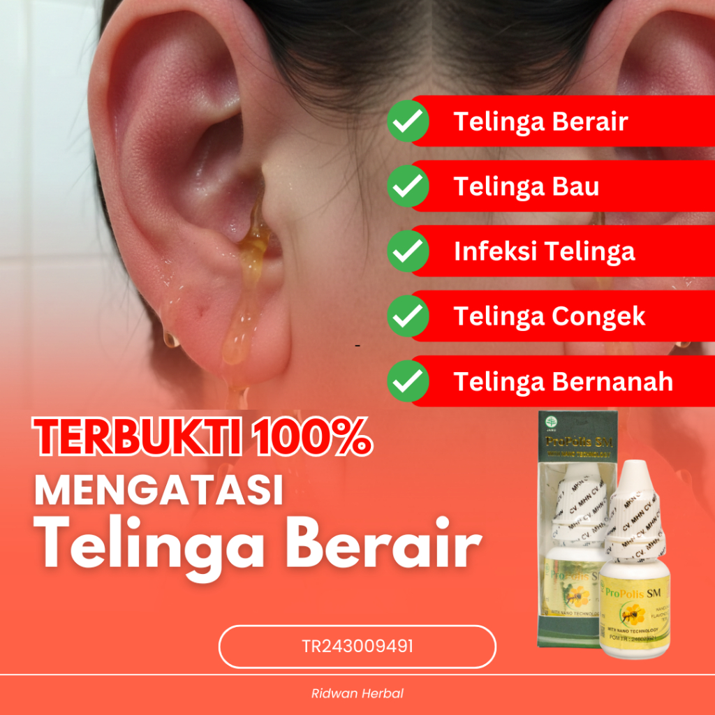 Obat Telinga Berair, Obat Telinga Congek, Obat Telinga Bernanah, Obat Telinga Budek, Obat Telinga Ba