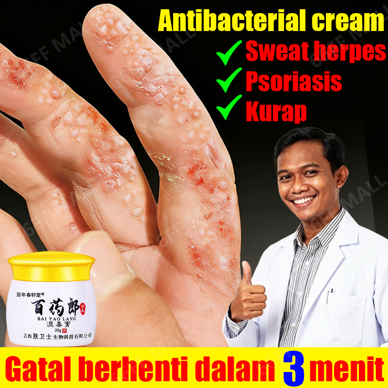 salep china gatal paling ampuh Obat kurap salap gatal kulit yang ampuh obat gatal selangkangan salep