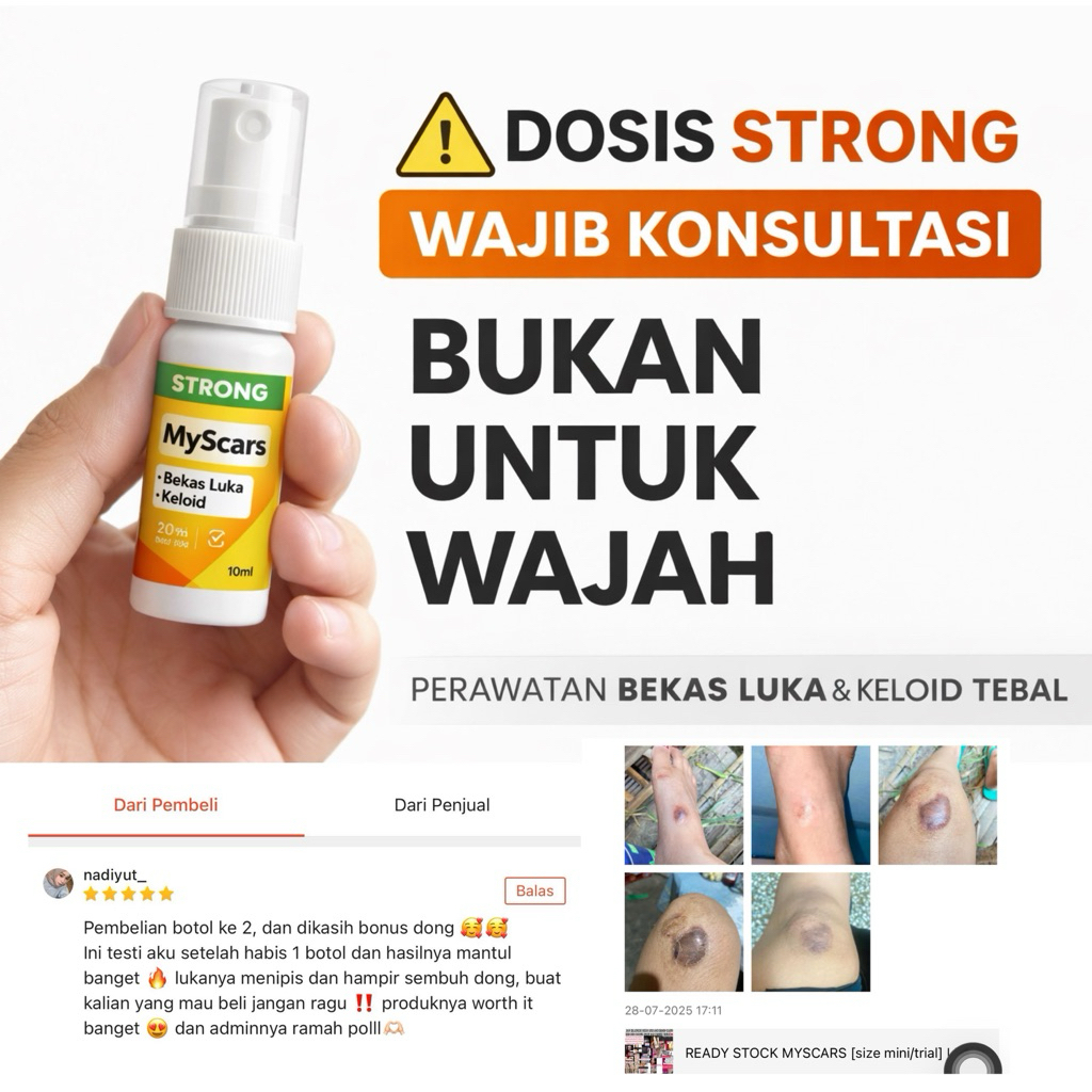MYSCARS Obat Keloid & Bekas Luka | Membantu Samarkan Luka & keloid lama | 10ml