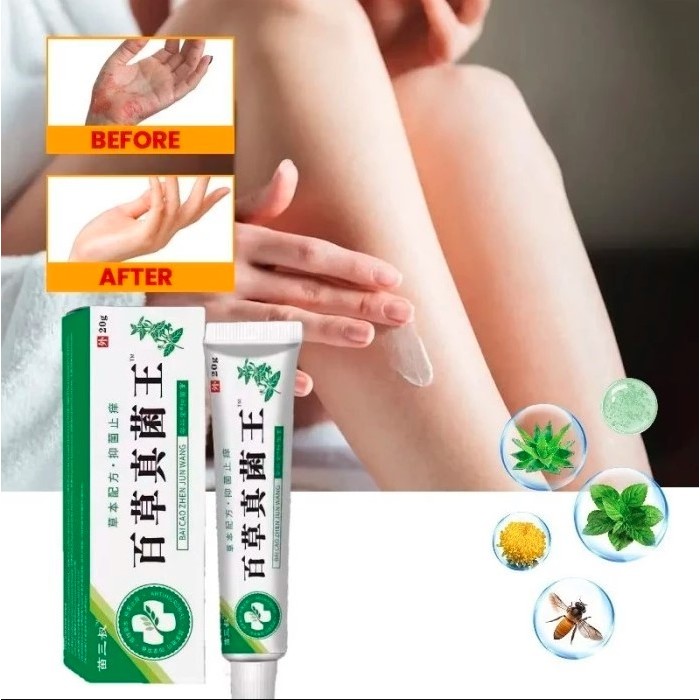 Salep gatal Bai Cao 20G  paling ampuh Obat psoriasis obat gatal salep kutil Obat Gatal Salep gatal S